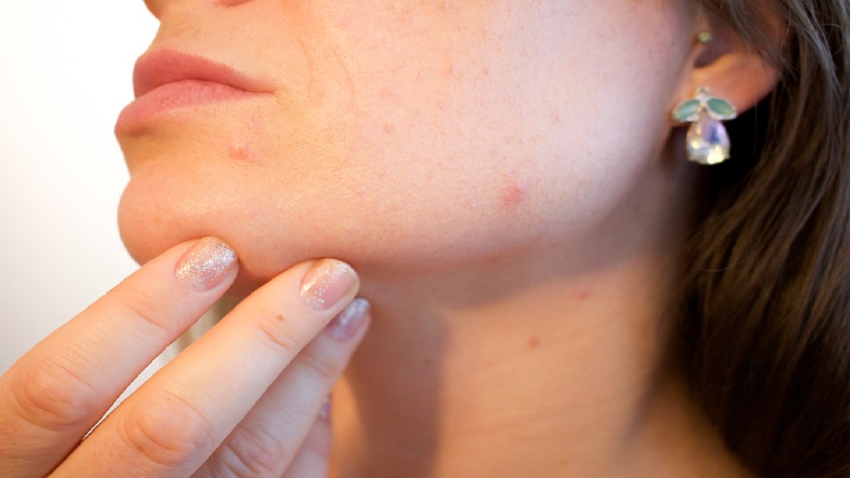Microbioma della pelle: cos’è e come proteggerlo?