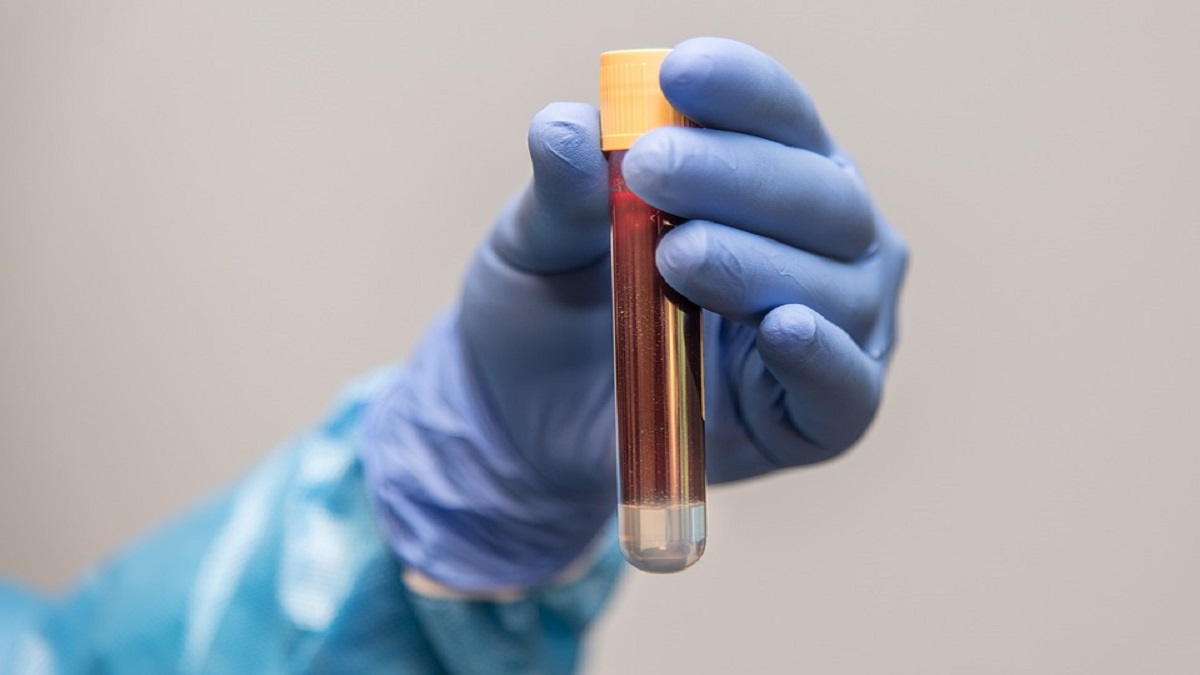 Covid, Cina esaminerà campioni di sangue raccolti nel 2019