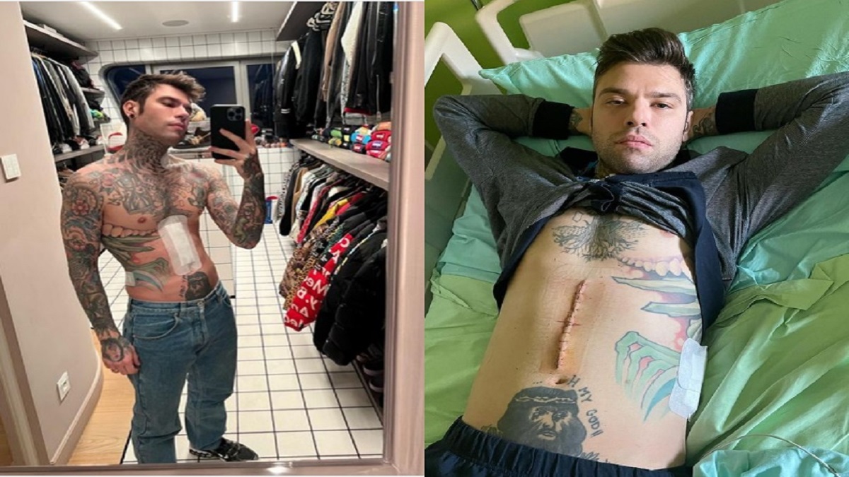 Fedez parla del tumore: ‘Non ha attaccato i linfonodi’